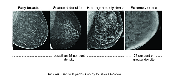 Screening Breast Dense Breast Image